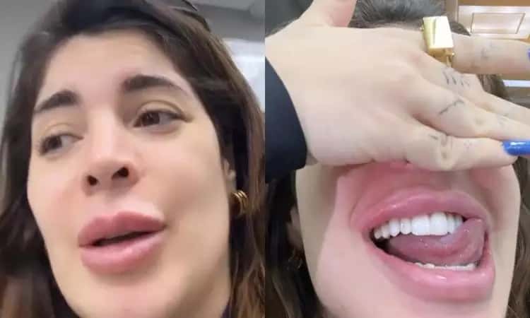 GKay agora tem dente de milhões