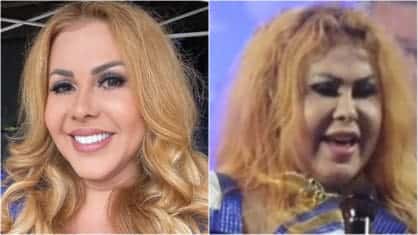 Joelma segue internada e cancela shows por inchaço no rosto