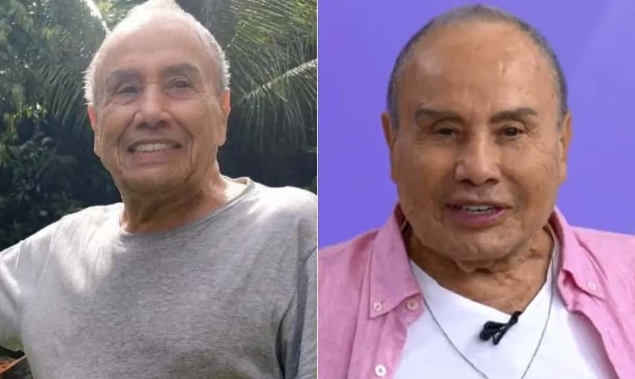 Stênio Garcia afirma que rosto está ‘normal’ após harmonização facial