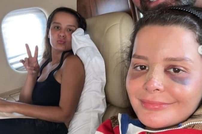 Maraisa mostra nariz quebrado e relata “momentos conturbados” em acidente