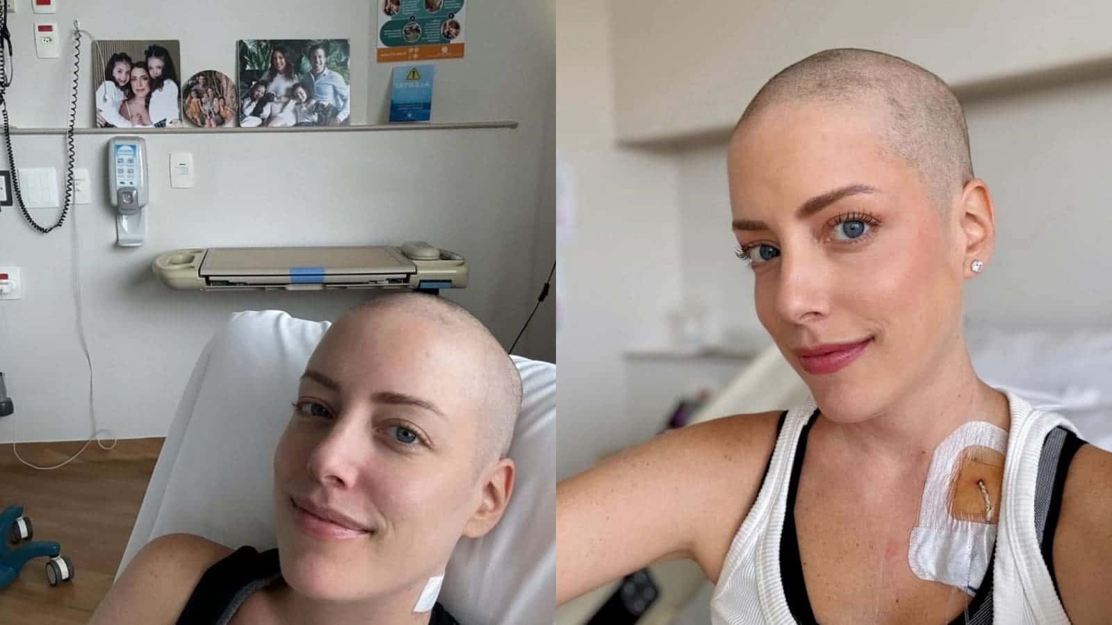 Durante tratamento de leucemia, Fabiana Justus celebra pequenas vitórias