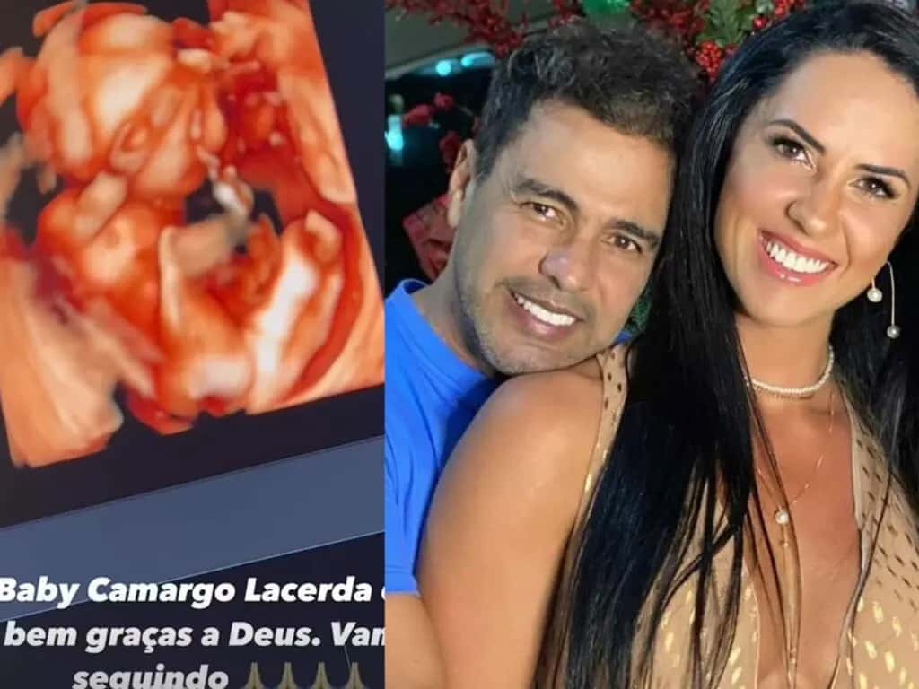 Graciele Lacerda mostra ultrassom do filho com Zezé Di Camargo