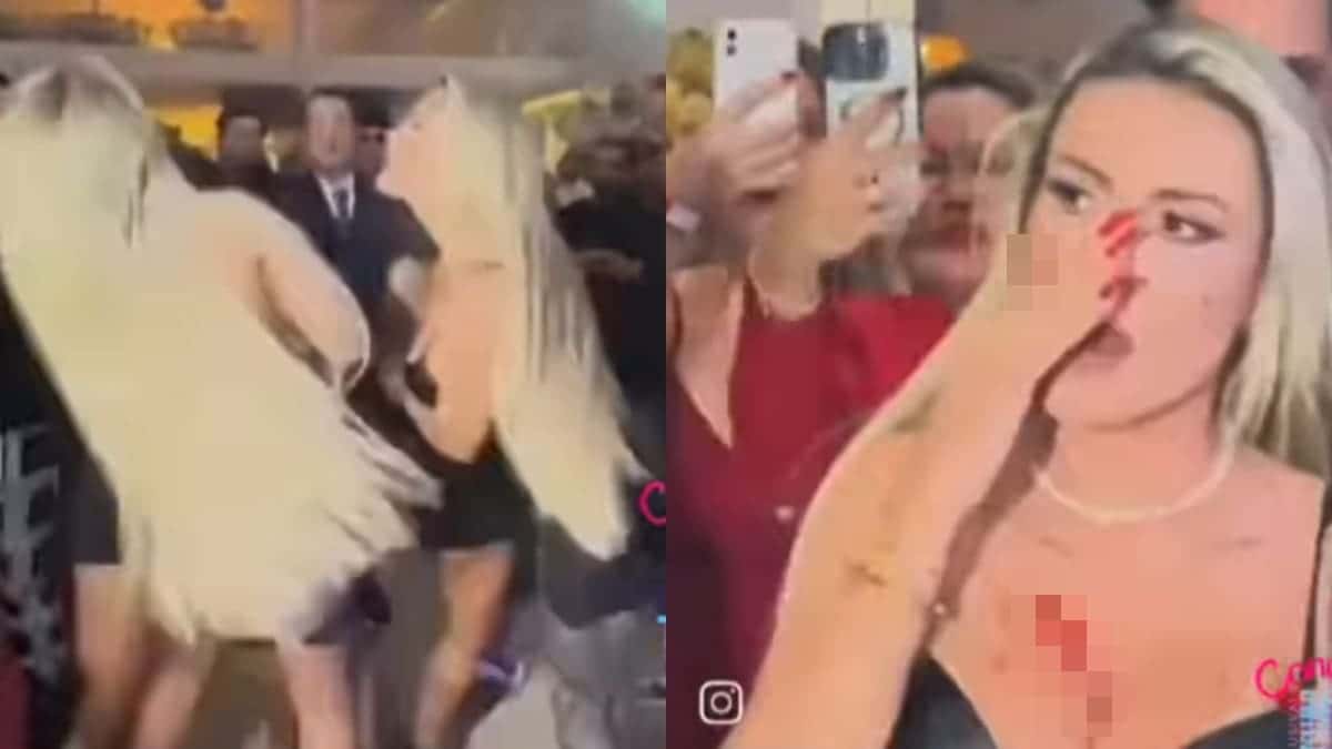 Andressa Urach fica ferida e precisa levar pontos após briga com Juju Ferrari