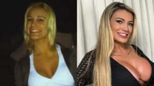 Antes e depois de Andressa Urach: vídeo mostra as mudanças da famosa ao longo dos anos