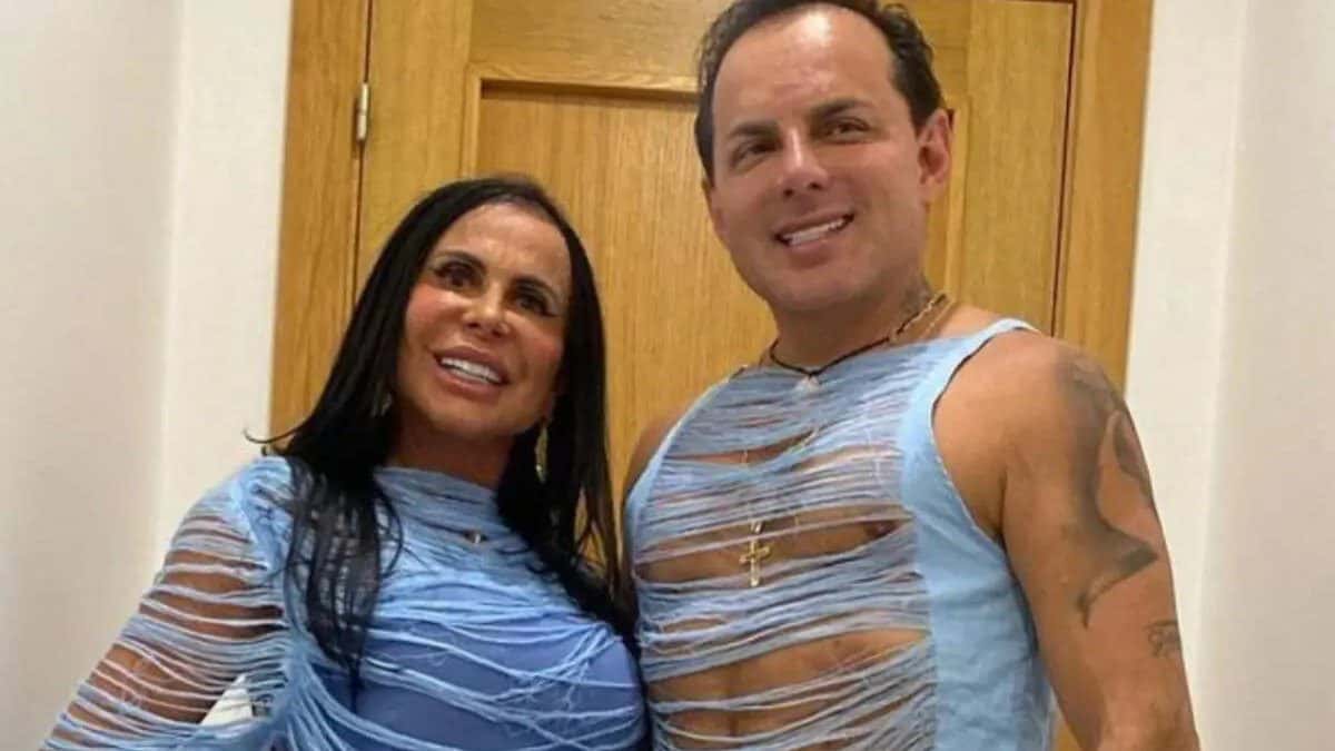 Marido de Gretchen impressiona com antes e depois de procedimentos no rosto