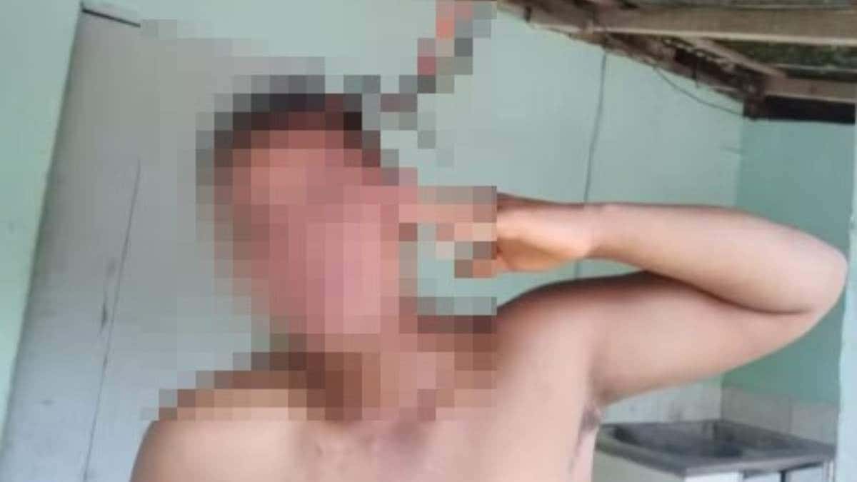 Adolescente fica com tesoura fincada na cabeça ao tentar separar briga