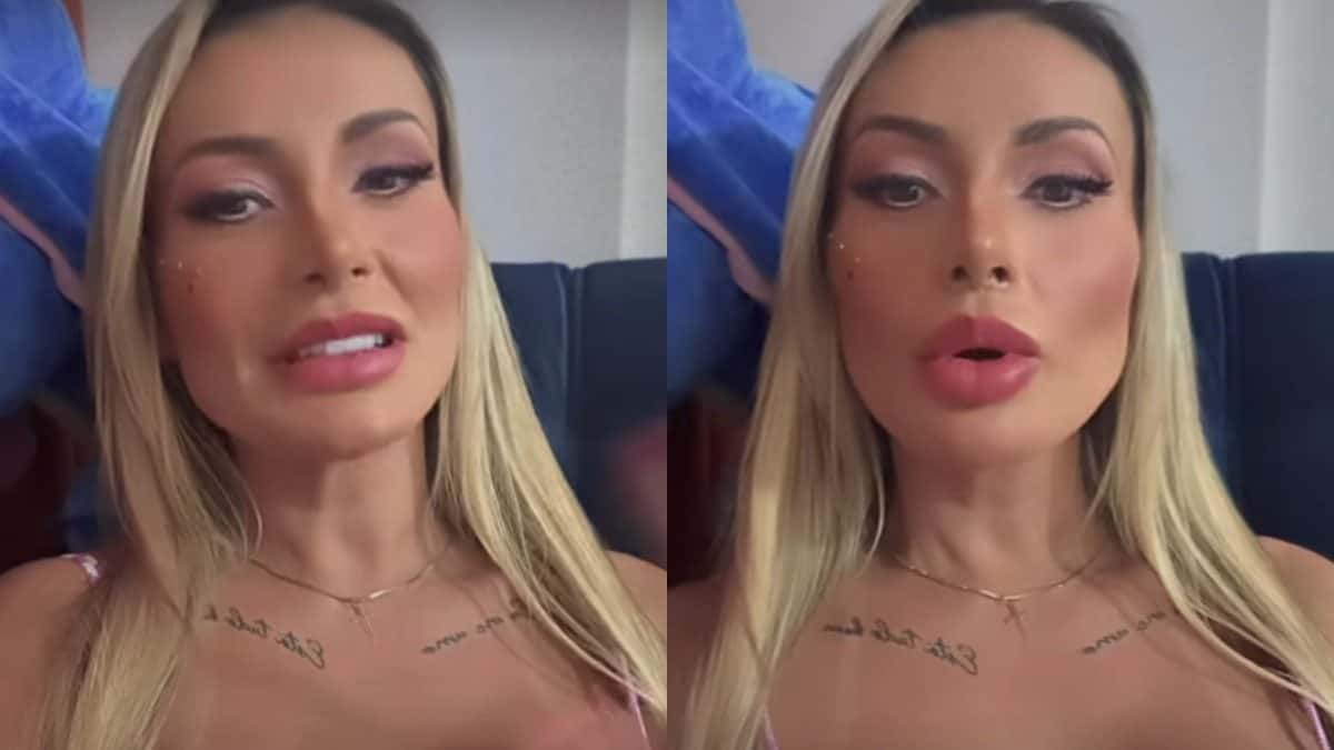 Andressa Urach expõe novos procedimentos estéticos e revela consequências