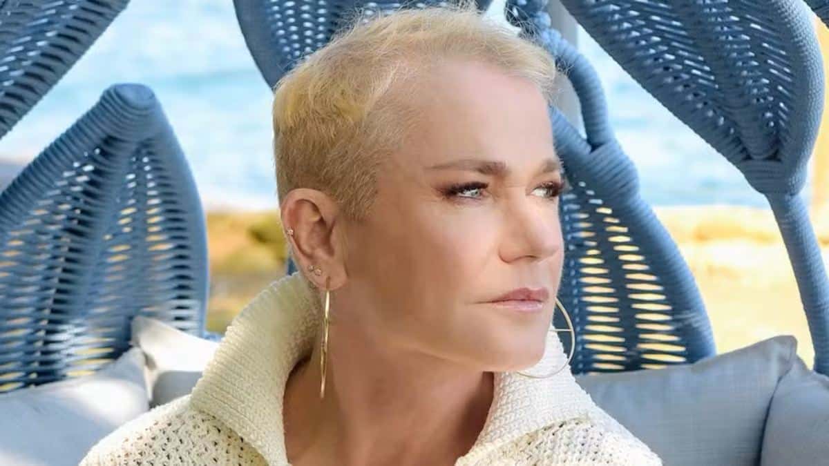 Xuxa tem alta hospitalar após cirurgia no joelho