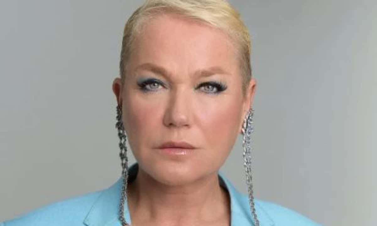 Xuxa Meneghel faz implante capilar para tratar alopécia