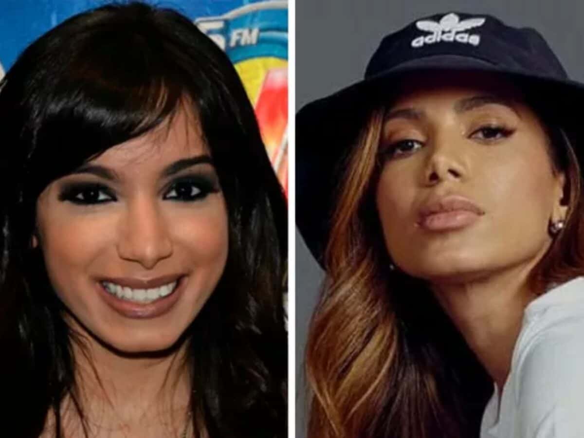 Todas as cirurgias plásticas de Anitta