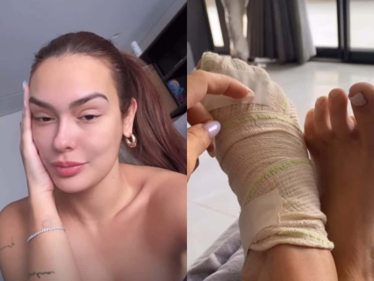 Ex-BBB Larissa Santos leva 14 pontos no pé após acidente com box do banheiro: “Dava para ver o osso”