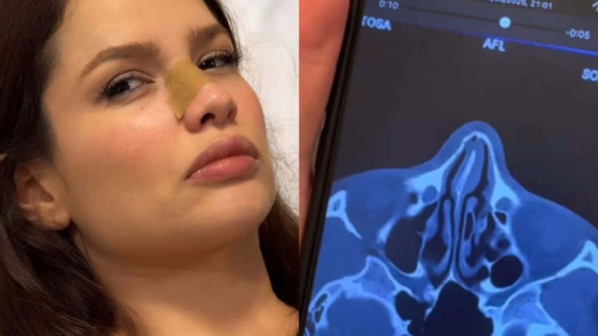 Juliette sofre pequena fratura no nariz após colisão