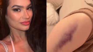 Grávida, Raissa Barbosa sofre queda em escada e vai parar em hospital