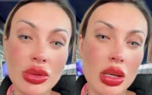 Andressa Urach pede orações após se arrepender de cirurgia nos olhos
