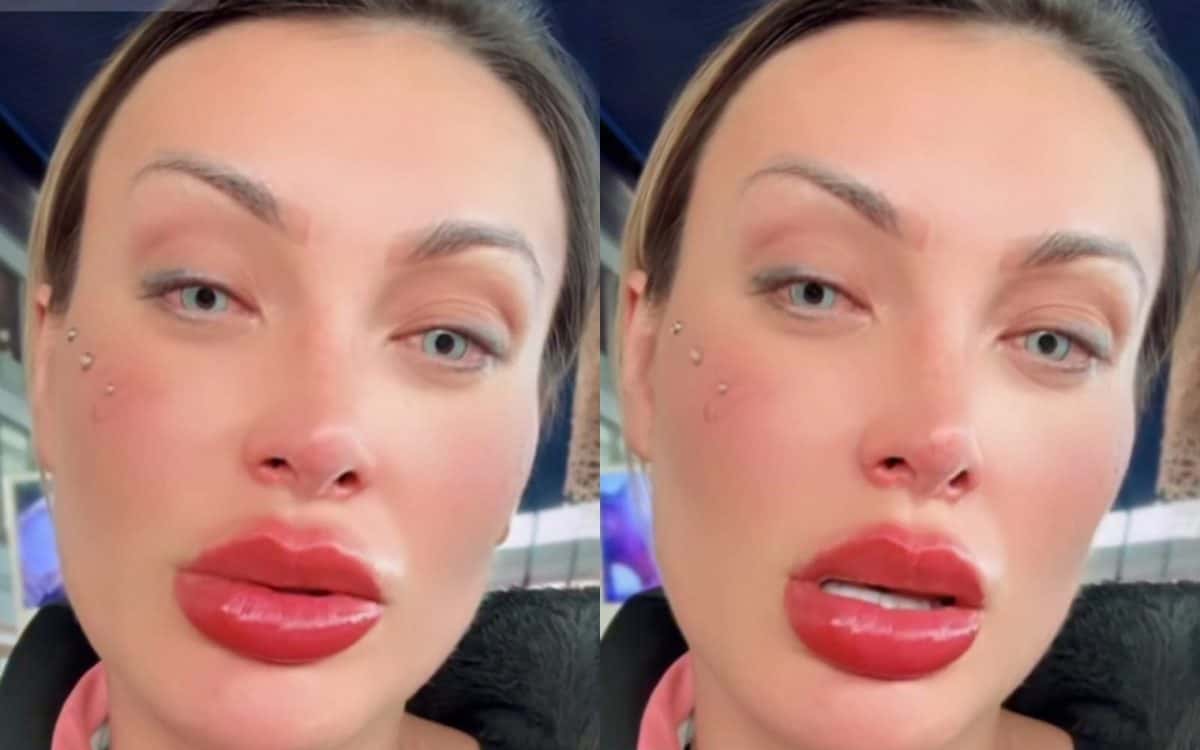 Andressa Urach pede orações após se arrepender de cirurgia nos olhos