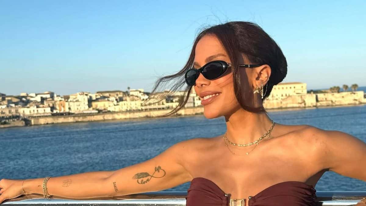 O que Anitta fez no rosto? Especialistas desvendam o que pode estar por de trás da mudança facial da cantora