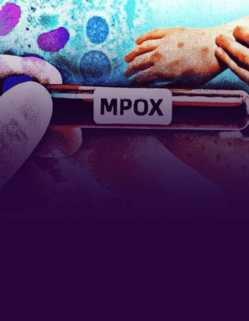Mpox: conheça os sintomas, as formas de transmissão e como se previnir
