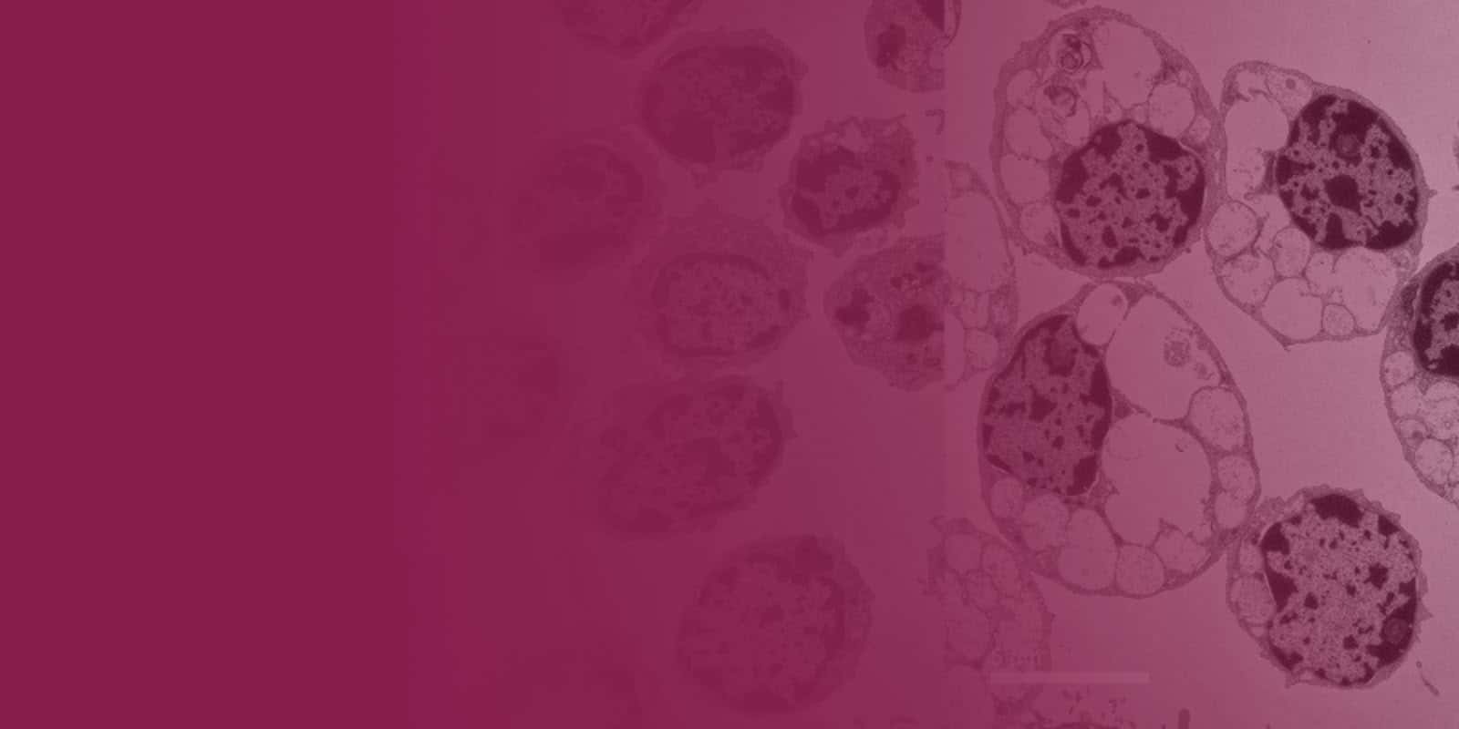 Estudo identifica mecanismo cerebral comum ao Alzheimer e a doença infantil