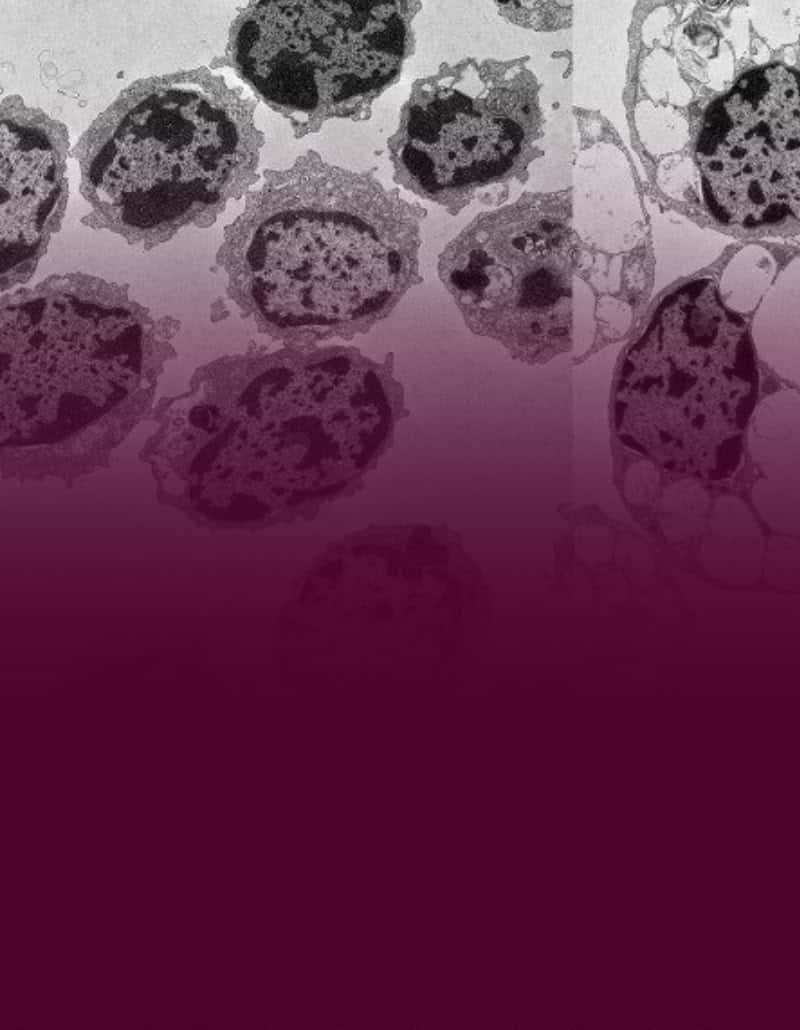 Estudo identifica mecanismo cerebral comum ao Alzheimer e a doença infantil