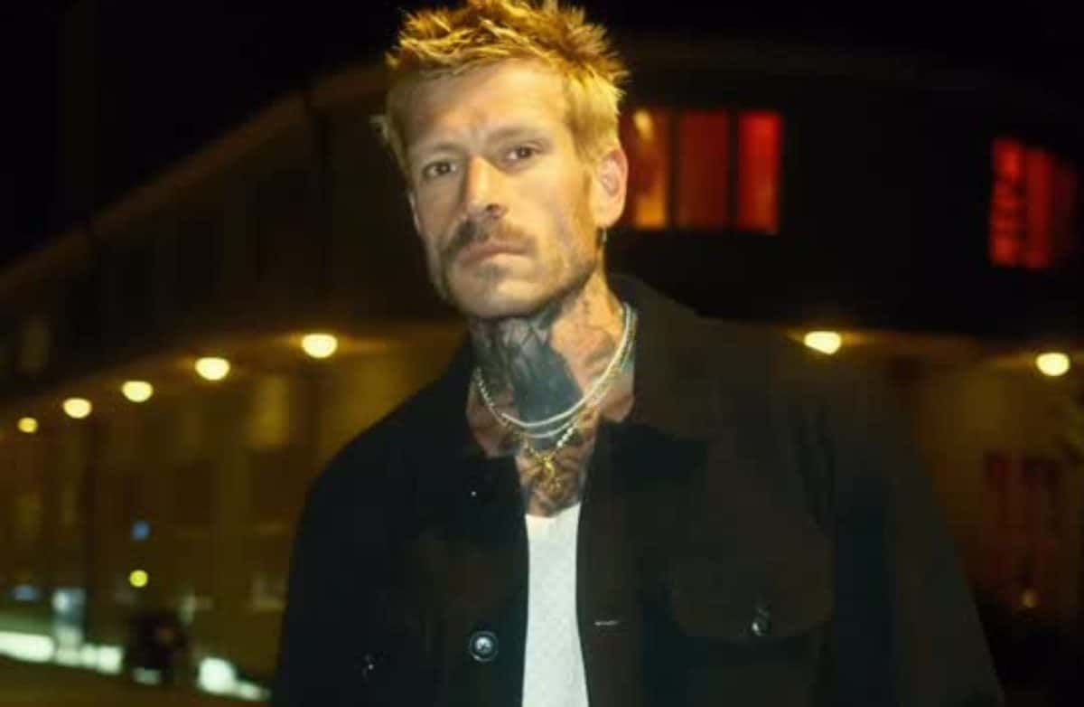 Mateus Verdelho atribui problema nas pálpebras a excesso de cafeína