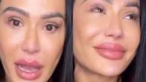 Gracyanne Barbosa se emociona ao falar de lesão no joelho