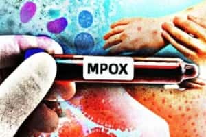 Mpox: conheça os sintomas, as formas de transmissão e como se previnir