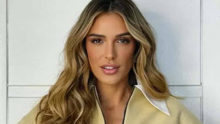 Rafa Brites desabafa sobre lipedema e mostra marcas no corpo: ‘Pesa 100 kg’