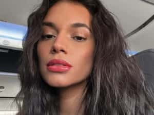 Alane Dias é atropelada no Rio e desabafa: “Muito rápido”