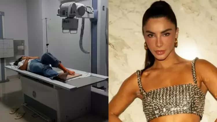 Gabriela Versiani sofre acidente doméstico e afirma: ‘Quebrou mesmo’