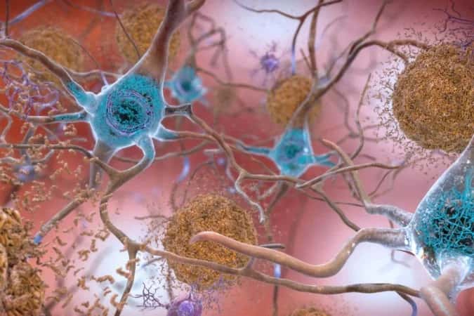 Revisão diz que drogas para Alzheimer não funcionam