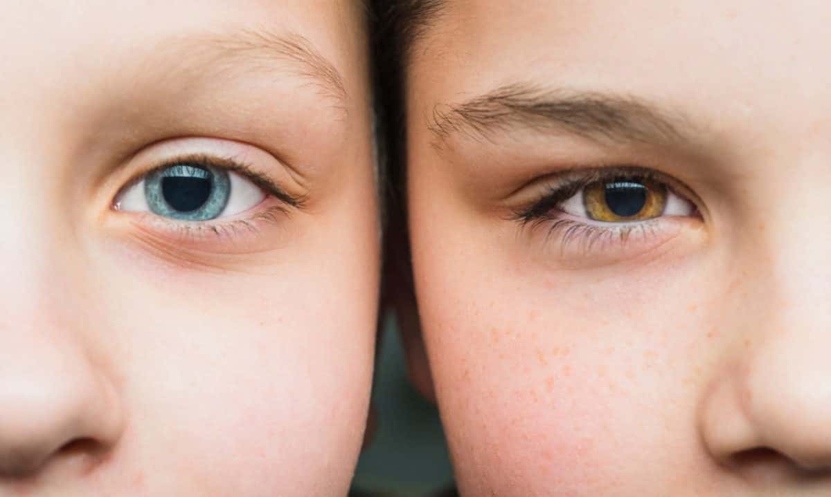 Transtorno do espectro autista pode ser identificado pela visão