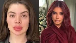 Gkay expõe arrependimento e revela distorção de imagem intensa