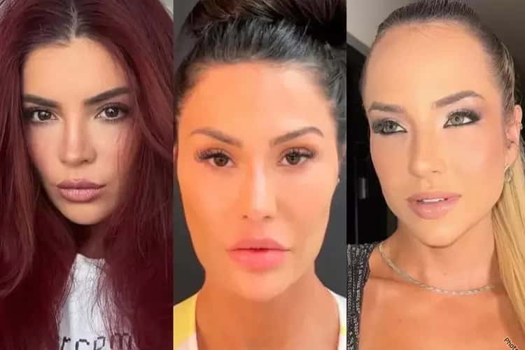 Famosas mudam o rosto e reacendem discussão sobre limites da estética