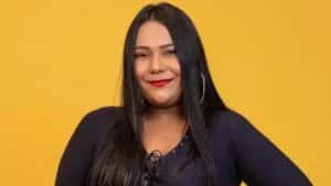 Ex-BBB Chaiany Andrade mostra resultado de harmonização e web reage