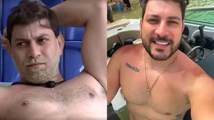 Ex-BBB Caio Afiune passa mal com forte crise alérgica e vai ao hospital