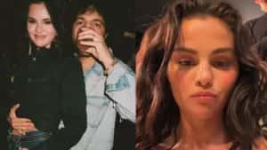 Benny Blanco expõe dieta inusitada de Selena Gomez com fast food pela manhã