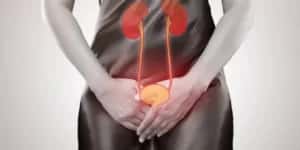 Infecção urinária: como prevenir recorrências e proteger os rins