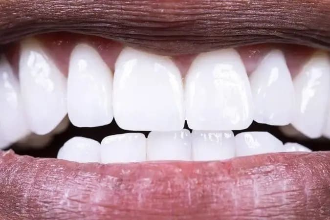 Como proteger as boas bactérias da sua boca