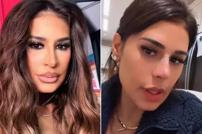 Simone Mendes muda o nariz sem cirurgia e coloca lifting com fios; entenda como funciona