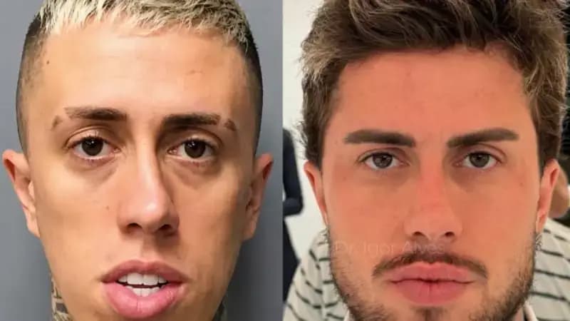 Antes e depois de MC Daniel choca a web: 'Nem parece a mesma pessoa'