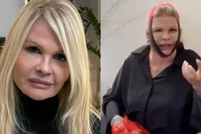 Monique Evans surge com rosto enfaixado e surpreende fãs; saiba o motivo