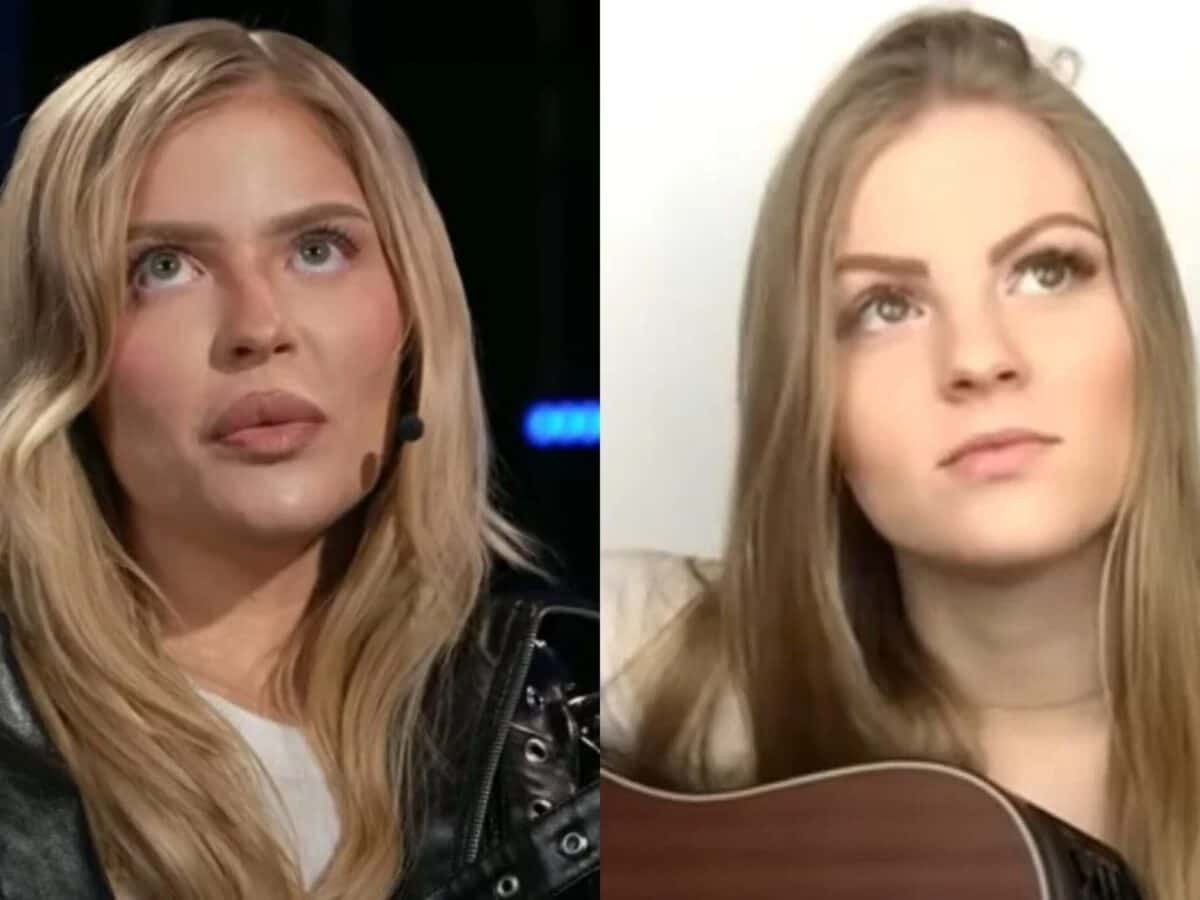 As famosas que já fizeram preenchimento labial