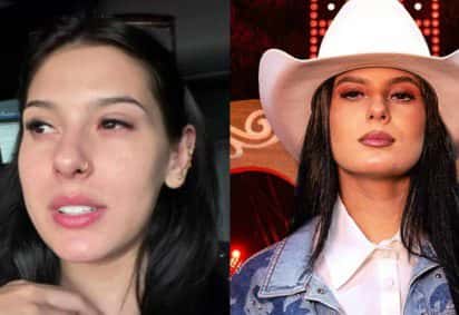 Ana Castela espanta público ao surgir com olho inchado e expõe motivo