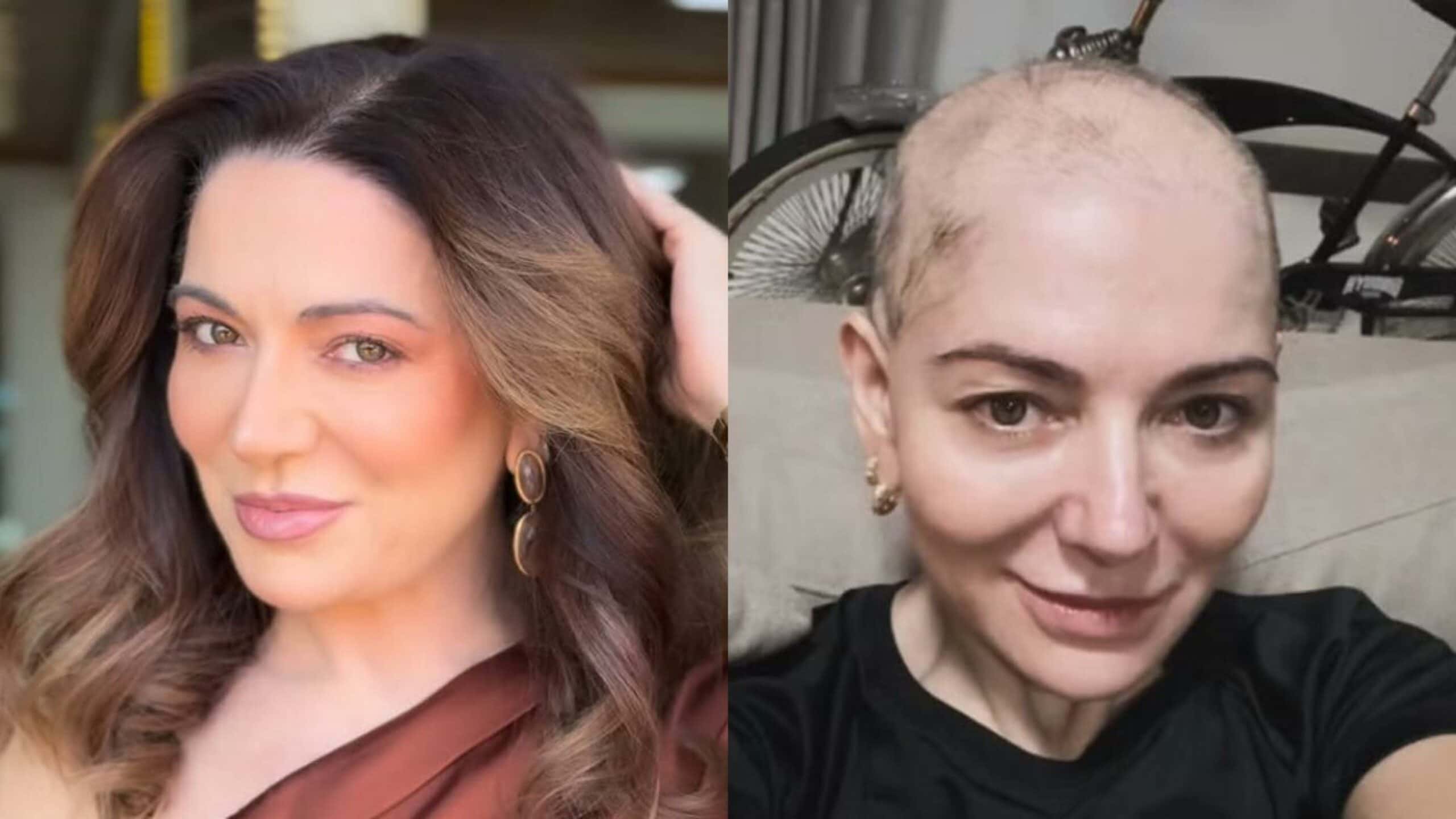 Mãe de Lucas Lucco raspa a cabeça após diagnóstico de doença autoimune