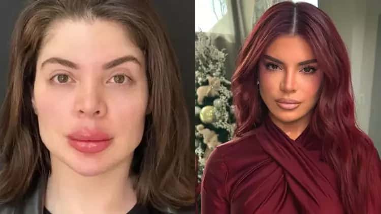 Gkay expõe arrependimento e revela distorção de imagem intensa