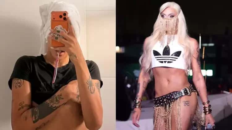 Pabllo Vittar passa por terceira rinoplastia e resultado chama atenção