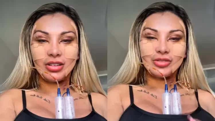 Andressa Urach gasta R$ 100 mil em cirurgia para voltar a ter 20 anos