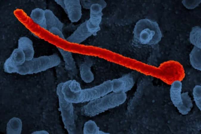 Suspeita de ebola em paciente de São Paulo é descartada