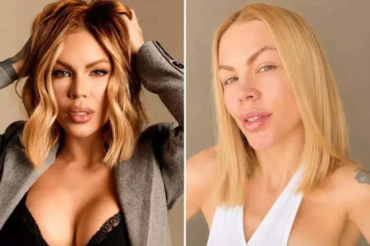 Influencer gasta R$ 100 mil para ‘desfazer’ o rosto após procedimentos