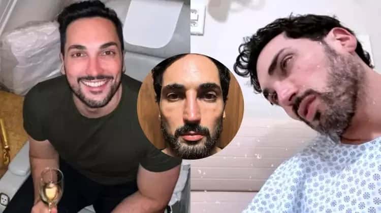Famoso fica com o rosto ‘derretido’ após usar Mounjaro e faz alerta